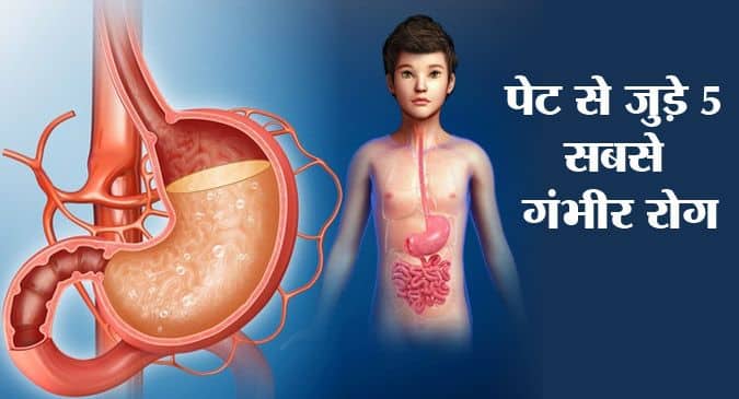 abdomen meaning in hindi 4