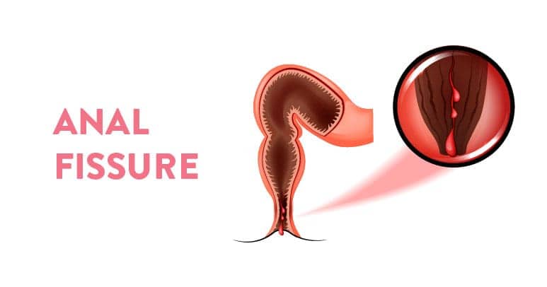anal meaning in hindi 3