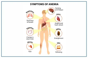 anemia meaning in hindi 1