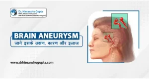 aneurysm meaning in hindi