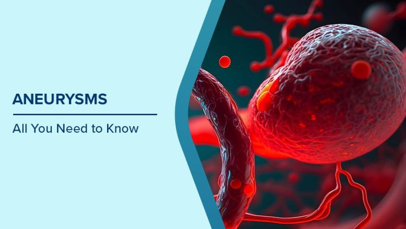 aneurysm meaning in hindi - Hình 4