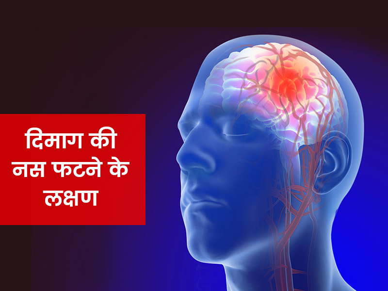aneurysm meaning in hindi - Hình 5