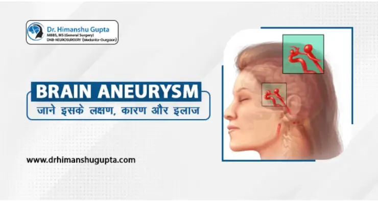aneurysm meaning in hindi - Hình 1