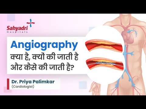एंजियोग्राफी क्यों की जाती है: आवश्यकताएं और उद्देश्य