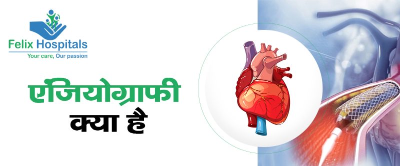 एंजियोग्राफी के प्रकार: विभिन्न तकनीकें और उपयोग