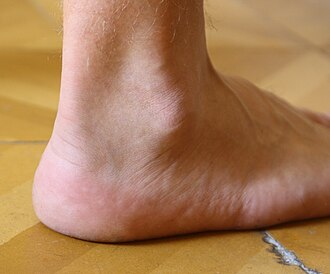 ankle meaning in hindi 2