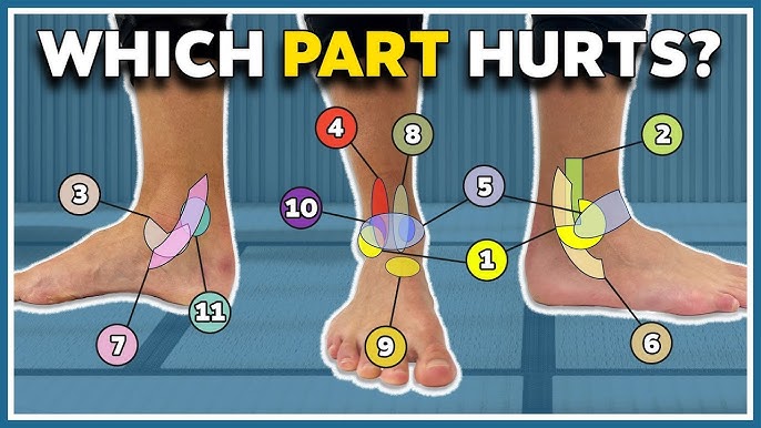 टखने से संबंधित सामान्य समस्याएं और हिंदी में उनके नाम (Common ankle problems and their names in Hindi)