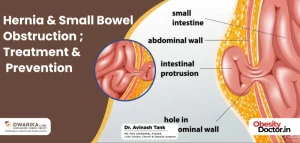 anus meaning in hindi 3