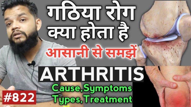 गठिया का हिंदी में अर्थ: एक व्यापक परिचय (गathiya ka hindi mein arth: ek vyaapak parichay)
