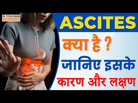 Ascites Ke Lakshan: Kaise Pahchane? (Ascites के लक्षण: कैसे पहचानें?)