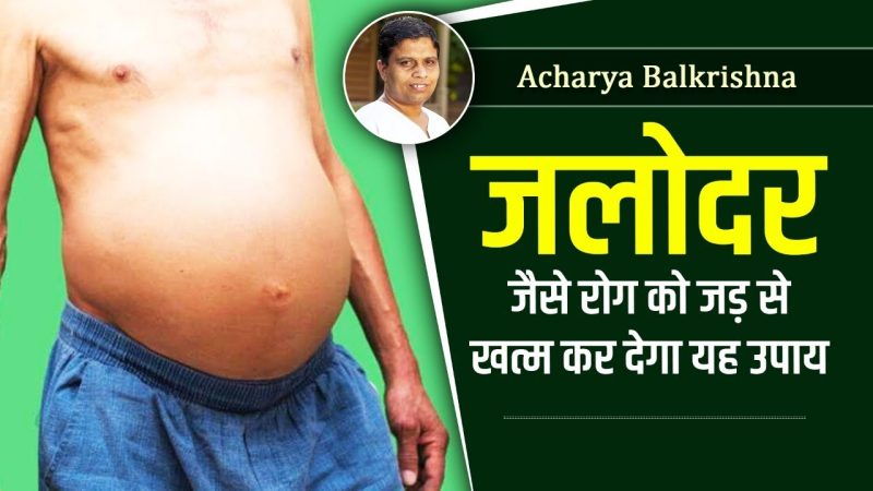 Ascites Ka Ilaj: Hindi Mein Jankari (Ascites का इलाज: हिंदी में जानकारी)