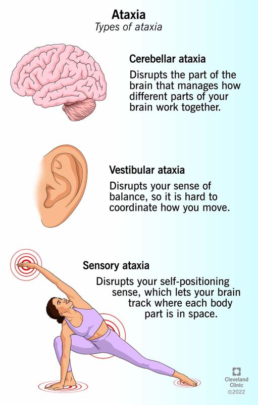 Ataxia Meaning in Hindi: अटैक्सिया क्या है? लक्षण, कारण और इलाज की पूरी जानकारी 7 ataxia meaning in hindi - Hình 5