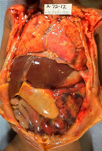 autopsy meaning in hindi - Hình 4