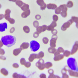 basophils meaning in hindi