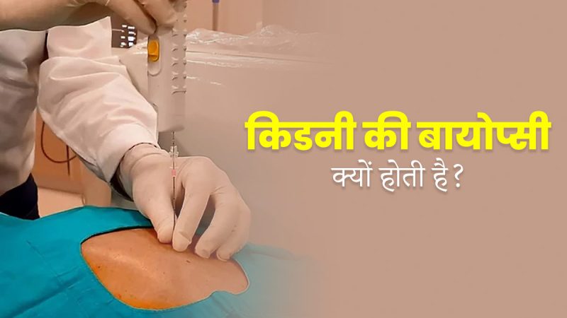 बायोप्सी क्यों की जाती है? कारण और चिकित्सा संकेत