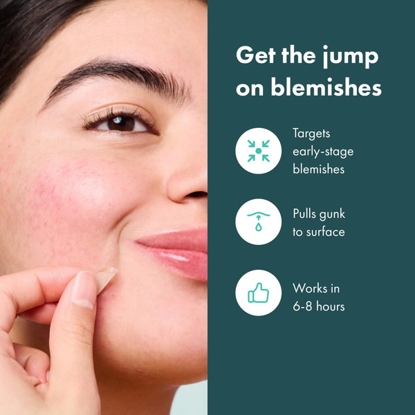 Blemishes का इलाज (Blemishes ka ilaaj)