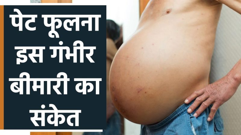 पेट फूलना: कारण, लक्षण और घरेलू उपचार