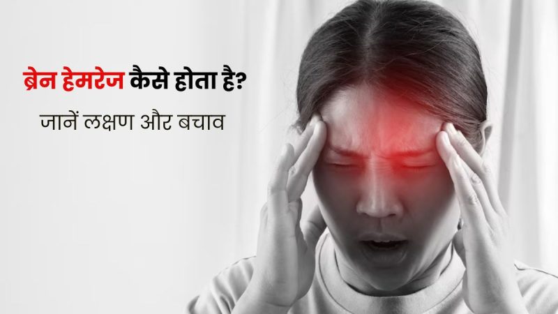 ब्रेन हेमरेज क्या है? हिंदी में पूरी जानकारी, कारण, लक्षण और इलाज 6 brain hemorrhage meaning in hindi - Hình 4