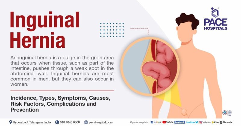 bulge meaning in hindi 1