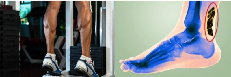 'Calves' का अर्थ 'पिंडलियां' या 'पैर की मांसपेशी' के रूप में