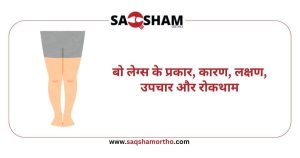 causes meaning in hindi 2