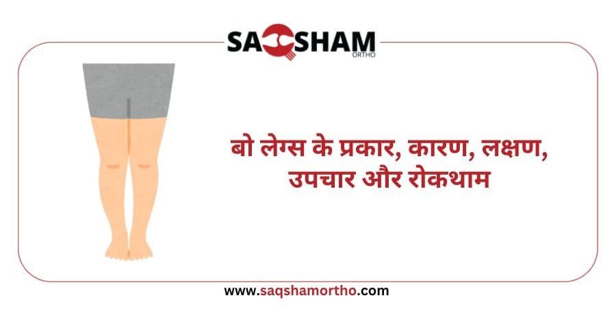 causes meaning in hindi 2