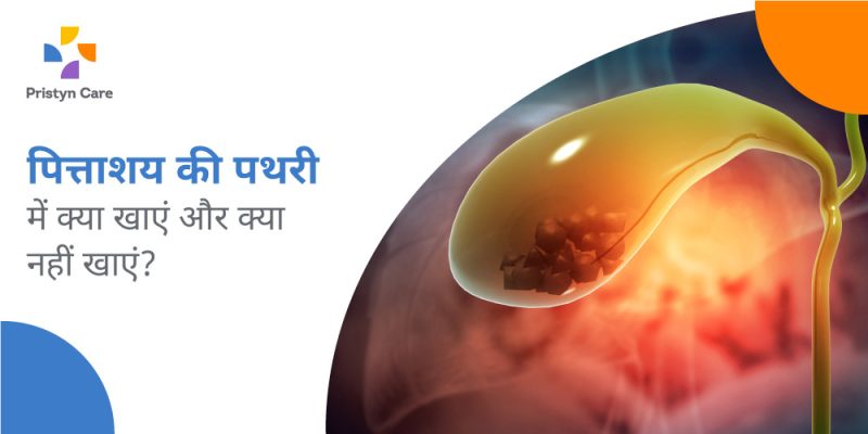 पित्ताशय की पथरी के कारण: हिंदी में विस्तृत स्पष्टीकरण  इस खंड में पित्ताशय की पथरी के कारणों को स्पष्ट किया जाएगा, जिसमें कोलेस्ट्रॉल, पित्त लवण और अन्य कारक शामिल हैं जो पित्ताशय की पथरी के विकास में योगदान करते हैं।