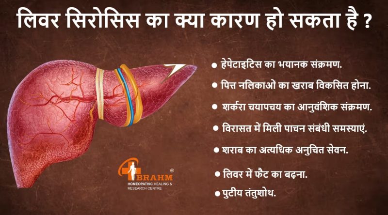 लिवर सिरोसिस के प्रमुख कारण क्या हैं?