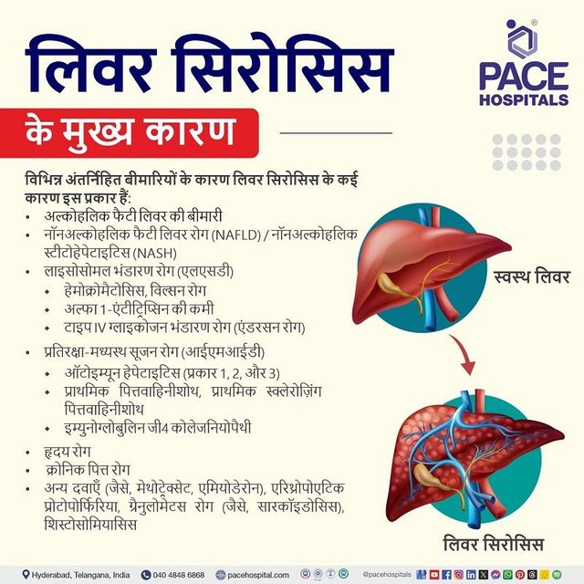 लिवर सिरोसिस का निदान कैसे किया जाता है?