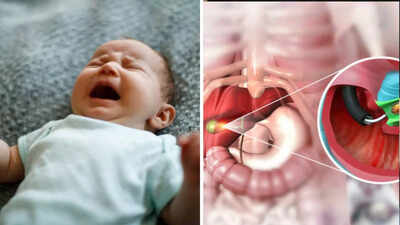 Colic Meaning In Hindi: उदरशूल क्या है? शिशु पेट दर्द के लक्षण, कारण, उपचार। 11 शूल (Colic) का प्रबंधन और घरेलू उपाय