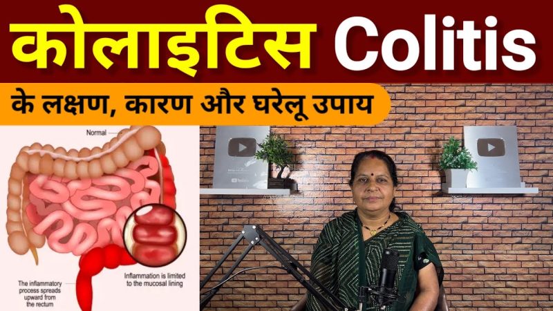 कोलाइटिस के प्रकार और उनके हिंदी नाम (Colitis ke prakar aur unke Hindi naam)  यहाँ कोलाइटिस के विभिन्न प्रकारों (जैसे अल्सरेटिव कोलाइटिस, क्रोहन रोग) को समझाया जाएगा, साथ ही उनके सामान्य हिंदी नामों को भी बताया जाएगा।