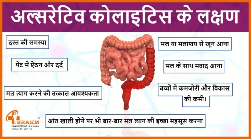 कोलाइटिस के कारण: हिंदी में समझें (Colitis ke karan: Hindi mein samjhen)  कोलाइटिस के संभावित कारणों (जैसे संक्रमण, ऑटोइम्यून प्रतिक्रिया, आनुवंशिक कारक) को सरल हिंदी में समझाया जाएगा।