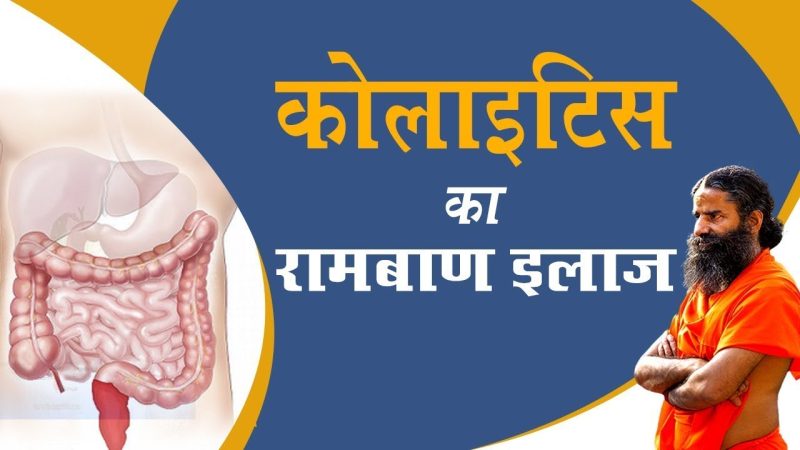 कोलाइटिस का इलाज: हिंदी में विकल्प (Colitis ka ilaj: Hindi mein vikalp)  इस खंड में कोलाइटिस के इलाज के विभिन्न विकल्पों (जैसे दवाएं, सर्जरी, आहार परिवर्तन) को हिंदी में प्रस्तुत किया जाएगा।