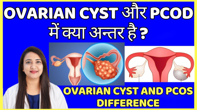 सिस्ट और ट्यूमर के बीच अंतर: मुख्य अंतर क्या हैं? (Cyst aur tumor ke beech antar: Mukhya antar kya hain?)