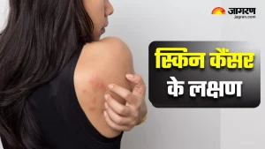 dermatologist meaning in hindi 5