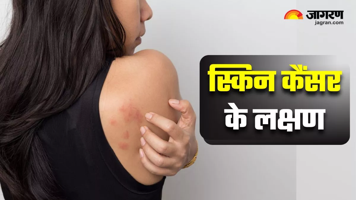 सामान्य त्वचा समस्याओं के लिए घरेलू उपचार और रोकथाम