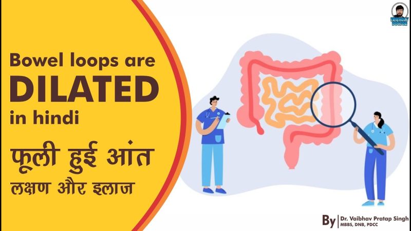 Dilated Bowel Loops का निदान (विस्तारित आंत लूपों का निदान)