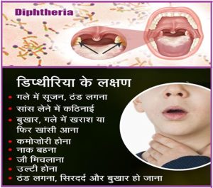 diphtheria meaning in hindi 1