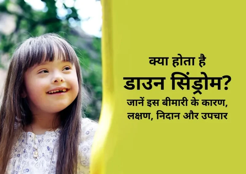 डाउन सिंड्रोम के कारण