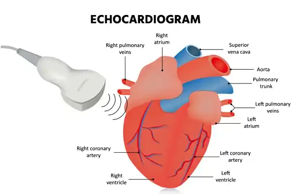 लाक्षणिक अर्थ में 'Echo' का प्रयोग