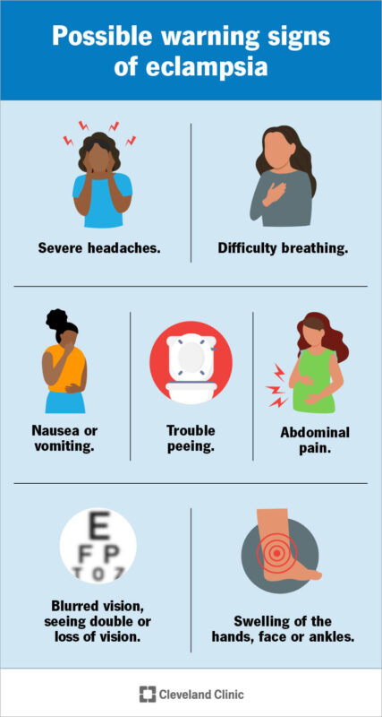 eclampsia meaning in hindi - Hình 5