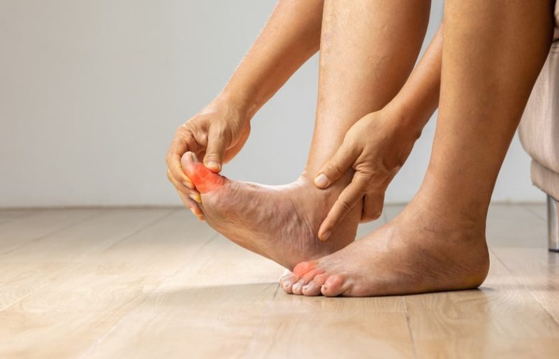 एडिमा के सामान्य कारण: कारण और जोखिम कारक  Edema ke saamaany kaaran: Kaaran aur jokhim kaarak