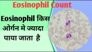 eosinophils meaning in hindi 4