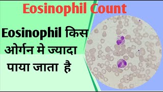 उच्च ईोसिनोफिल काउंट के कारण (Ucch Eosinophil Count Ke Karan)