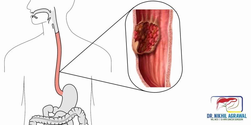 ग्रासनली के मुख्य कार्य (Esophagus Function): भोजन का परिवहन और पाचन में भूमिका
