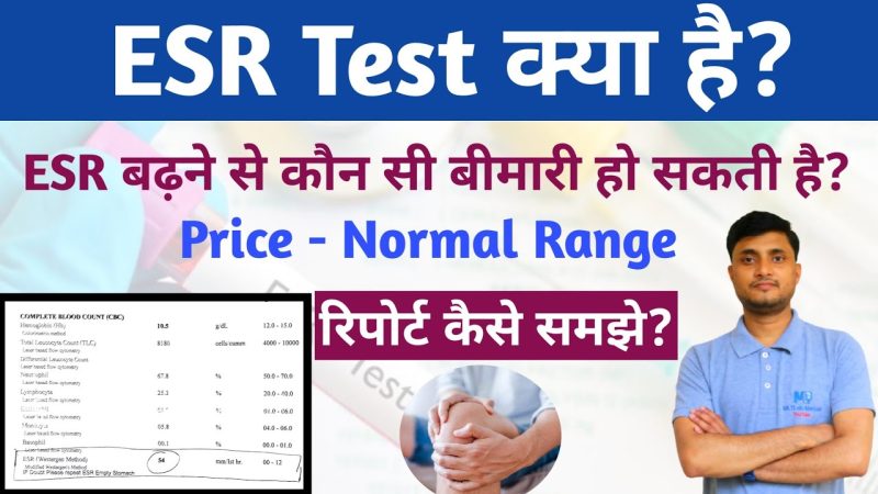 ESR का हिंदी में अर्थ: व्यापक समझ