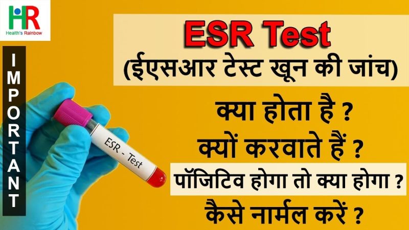 ESR के उपयोग: हिंदी में उदाहरण (ESR Ke Upyog: Hindi Mein Udaharan)