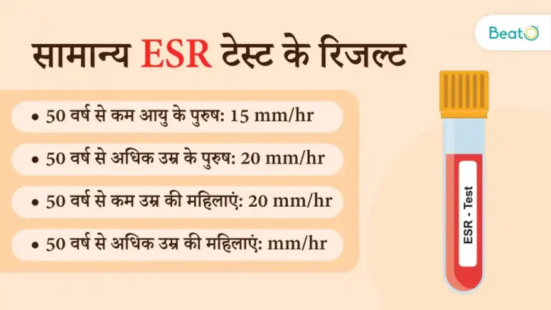 हिंदी में ESR के बारे में अक्सर पूछे जाने वाले प्रश्न (Hindi Mein ESR Ke Bare Mein Aksar Puche Jane Wale Prashn)