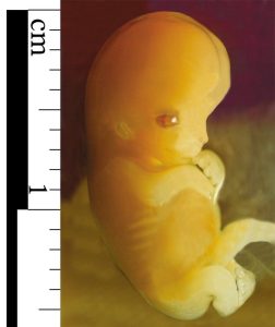 fetus meaning in hindi 4