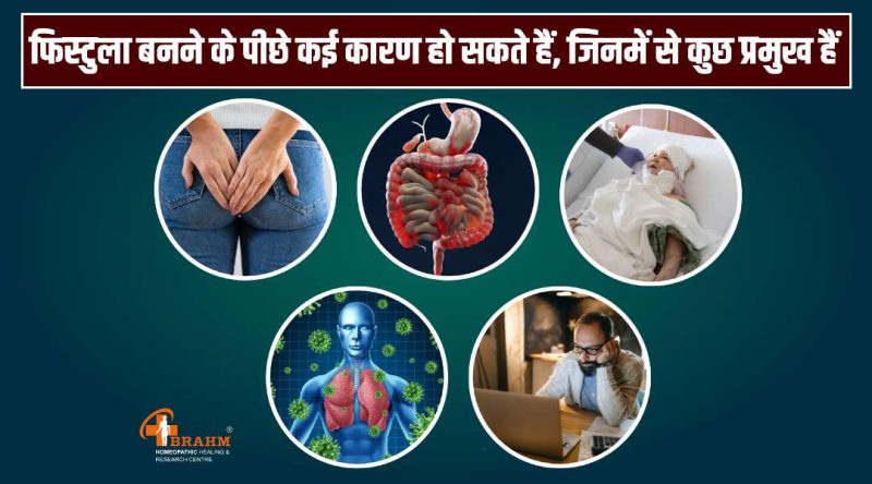 फिस्टुला के लक्षण, कारण और जोखिम कारक